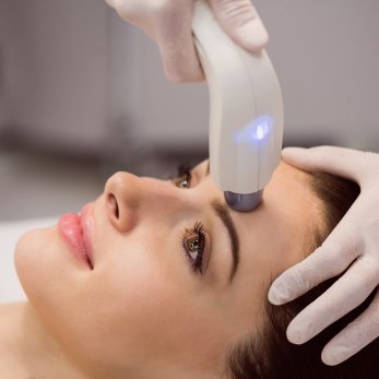 ultherapy laser facial treatment